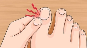 Ayak Parmağında İltihap Belirtileri ve Tedavisi