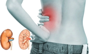 Böbrek İltihabı Belirtileri ve Tedavisi