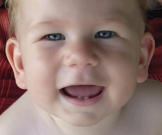 Bebeklerde Diş Eti İltihabı, Belirtileri ve Tedavisi iltihap.gen.tr